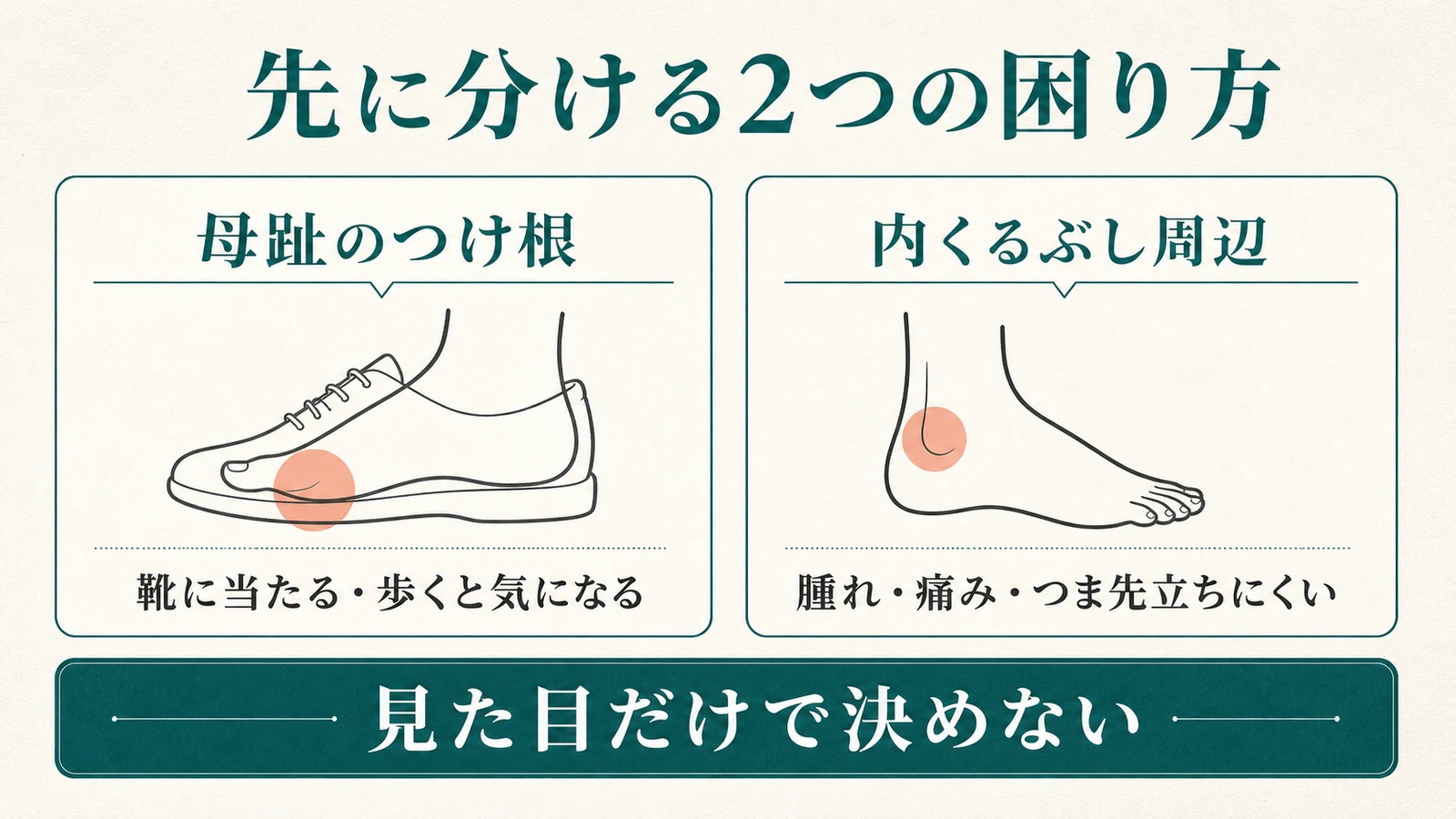 母趾のつけ根と内くるぶし周辺の困り方を分ける図
